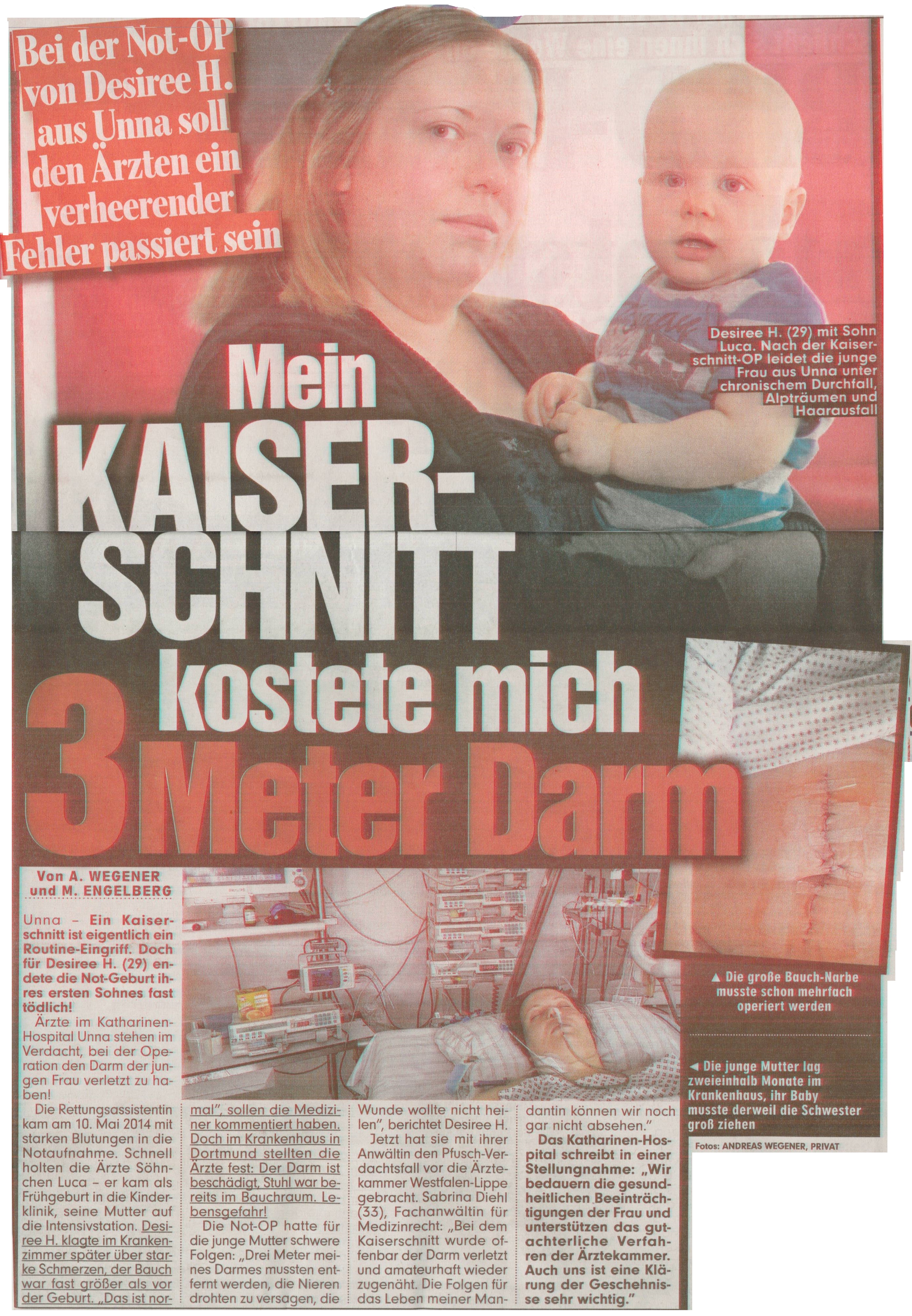 BILD vom 03.08.2015 Mein Kaiserschnitt kostete mich 3 Meter Darm Not OP Unna Marl Oberhausen Geburt Sabrina Diehl Fachanwältin für Medizinrecht