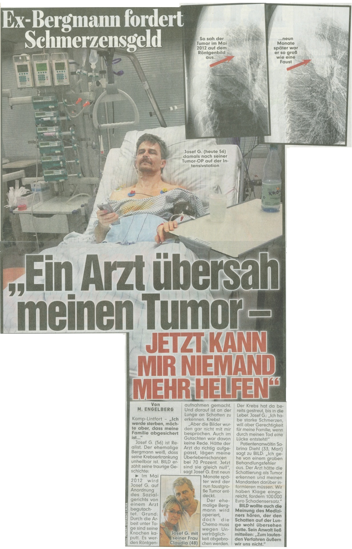 BILD vom 13.08.2015 Ex Bergmann fordert Schmerzensgeld Ein Arzt übersah meinen Tumor Marl Patientenanwältin Kamp Lintfort Chemo Behandlungsfehler Ärztepfusch