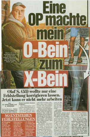 BILD vom 23.01.2015 Eine OP machte mein O Bein zum X Bein Sabrina Diehl Fachanwältin für Medizinrecht Schmerzensgeld Marl Oberhausen Arztfehler